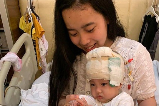 Bé sinh non bị não úng thủy trải qua 16 lần mổ vẫn chưa “thoát” bệnh viện