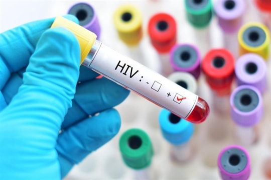 Tăng tỷ lệ bệnh nhân HIV tham gia bảo hiểm y tế