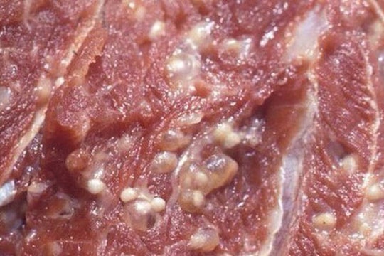 Cục Y tế dự phòng (Bộ Y tế) khuyến cáo 4 điều cần làm để phòng nhiễm sán lợn