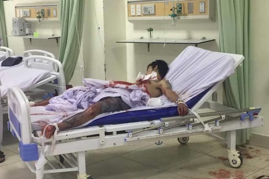 Cứu sống nam thanh niên "ngáo đá" tự cứa cổ, mổ ngực