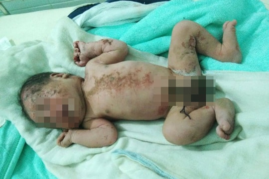 Phát hiện bé trai sơ sinh bị bỏ rơi bên suối