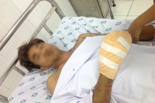 Suýt mất bàn tay do dùng điện thoại lúc sạc pin