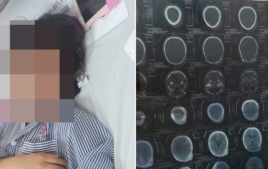 Nữ sinh cấp 3 bị đánh hội đồng phải nhập viện cấp cứu