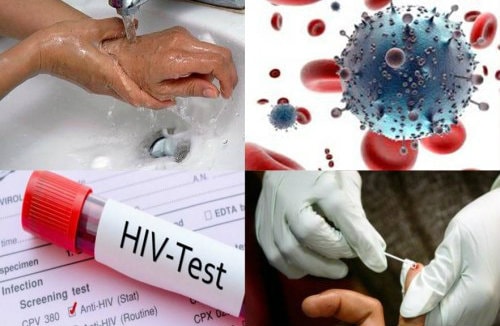 Từ vụ 10 người dân bị kẻ lạ mặt tấn công, cần hiểu đúng để xử lý an toàn khi nghi ngờ phơi nhiễm HIV