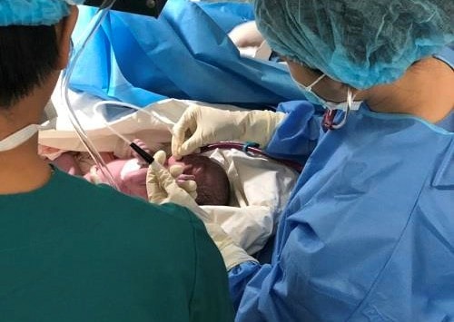 20 bác sĩ chạy đua cứu song thai bị bệnh lý tim ngay khi chào đời