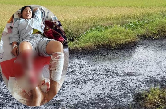 Vụ bỏng nặng khi lội mương: Chi hơn 6 tỷ đồng xử lý chất thải độc hại