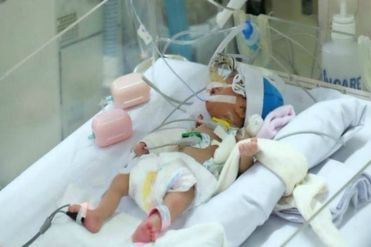 Hơn 10.000 em bé mắc bệnh tim được cứu sống trong 12 năm