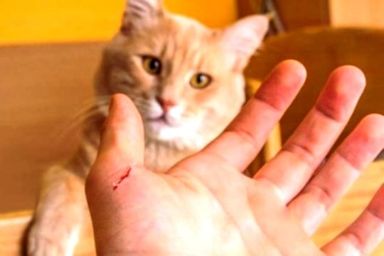 Bé trai 11 tuổi tử vong vì bị mèo cào