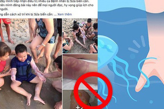 Sự thật về bài viết “Cảnh báo mùa sứa biển” đang gây xôn xao MXH