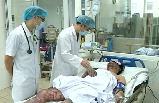 Ăn thịt lợn chết, người đàn ông 48 tuổi mất mạng