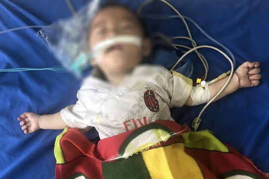 Bé trai 12 tháng tuổi nguy kịch vì ngộ độc thuốc phiện