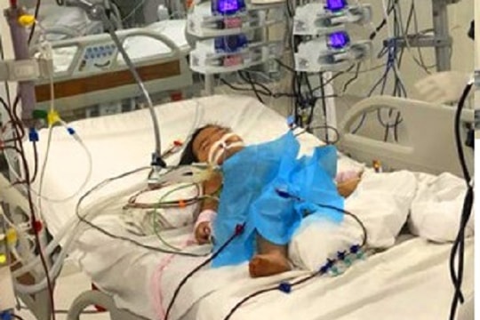 Cứu sống bé trai 3 tuổi sau khi uống nhầm xăng