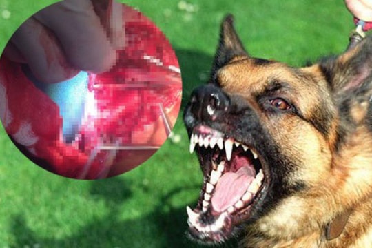 Chó dữ vào chợ tấn công cắn nhiều người dân