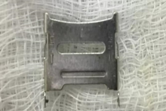 Lấy khay sim điện thoại khỏi hạ họng bé gái 2 tuổi ở Hà Nội