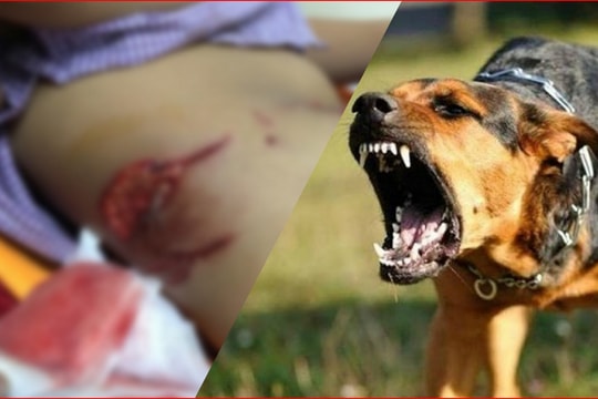 Bé trai 7 tuổi bị chó lai nặng 30kg tấn công kinh hoàng