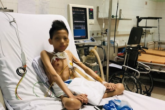 Cuộc sống "trong lồng kính" của thiếu niên 17 tuổi nặng 30 kg được ghép phổi với chi phí 5 tỉ đồng