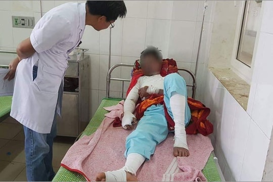 Điện thoại phát nổ khi vừa sạc vừa chơi game, nam thanh niên bị bỏng nặng