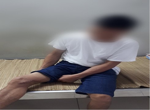 Phát hiện thêm bệnh nhân bị vi khuẩn “ăn thịt người” tấn công ở Thái Nguyên