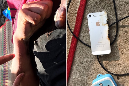 Nổ điện thoại lúc đang sạc pin, nam thanh niên tử vong