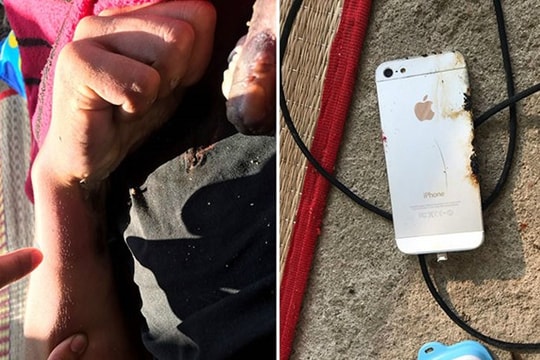 Những vụ điện thoại phát nổ khi đang sạc gây hậu quả khủng khiếp cho người dùng