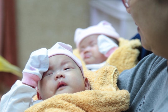 Cặp song song sinh dính liền vùng ngực và gan được xuất viện