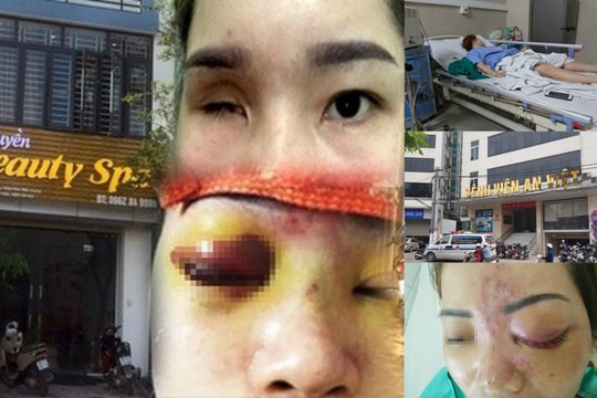 Rùng mình với những biến chứng khủng khiếp từ việc “làm đẹp”