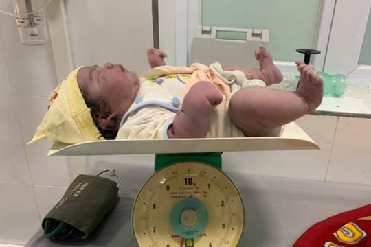 Hy hữu: Bé gái nặng 5,5 kg chào đời bằng phương pháp sinh thường