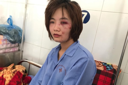 Cảnh sát làm rõ nhóm thanh niên đánh nữ phụ xe buýt nhập viện