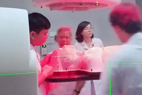 Giảm hơn 20 lần xạ trị nhờ ứng dụng thuật toán nhằm trúng đích khối u