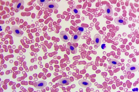 Chuyên gia bác tin đồn virus lạ gây viêm cơ tim tử vong nhanh chóng