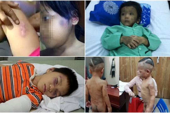 Xót lòng những đứa trẻ bị bố dượng bạo hành gây chấn động