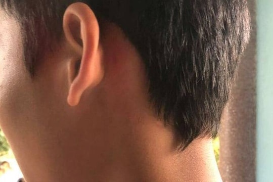 5 người lớn vào trường hành hung nam sinh lớp 8