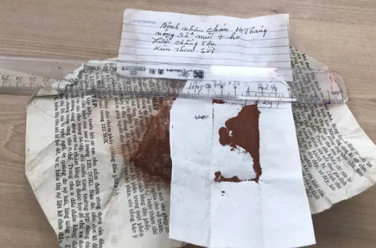 Bệnh nhi 14 tháng tuổi bị nhiễm độc chì nghiêm trọng do bôi thuốc cam