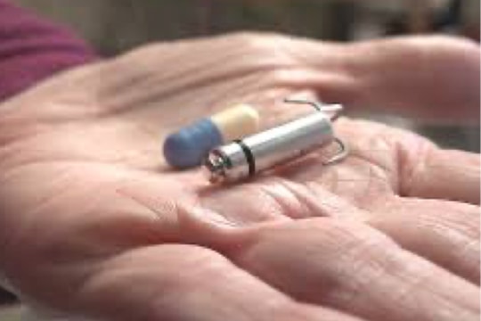 Việt Nam cấy máy tạo nhịp tim nhỏ như viên thuốc con nhộng