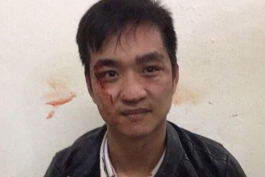 Hà Nội: Bắt tên cướp vào tiệm vàng giật dây chuyền và nhẫn