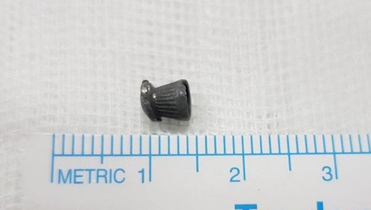 Gắp thành công viên đạn "sống nhờ" 20 năm trong ngực