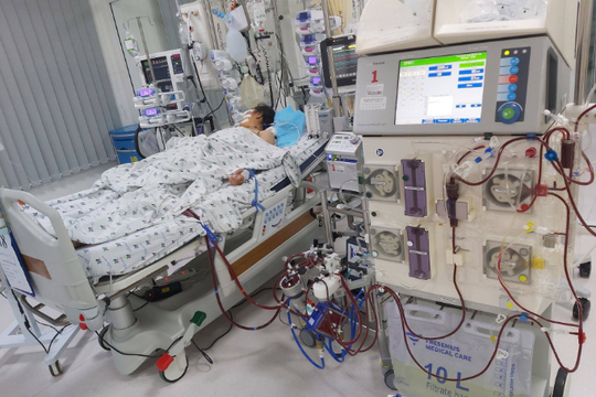 Cứu sống 2 bệnh nhi bị viêm cơ tim nguy kịch nhờ tim phổi nhân tạo