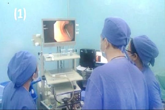 Cấp cứu cùng lúc cho 2 bé trai nuốt đinh nhọn suýt thủng ruột non