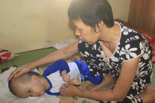Thương cảm cảnh người phụ nữ mù lòa ôm con bị não úng thủy nằm liệt giường