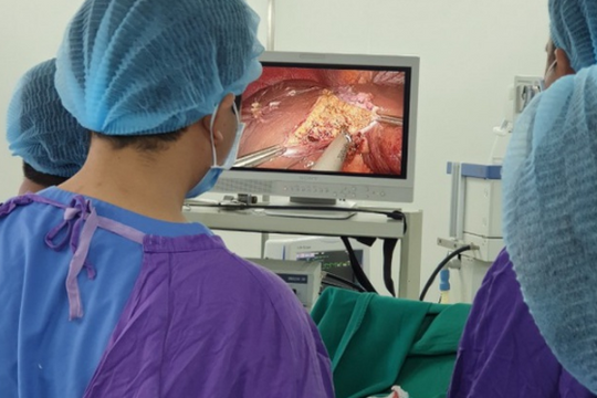 Nội soi cắt u gan cho nữ bệnh nhân 39 tuổi mắc ung thư gan