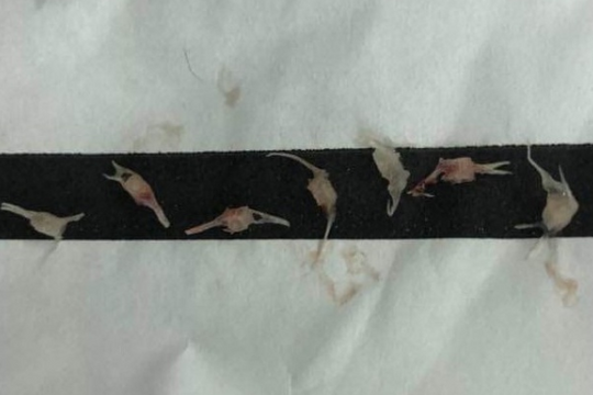 Bé 1 tuổi bị hóc 7 xương cá khi ăn cháo