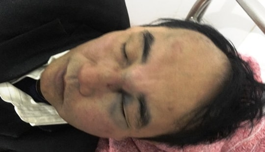 Bác sĩ bị hành hung vì phản đối quán trà chanh dựng xe chắn lối vào nhà