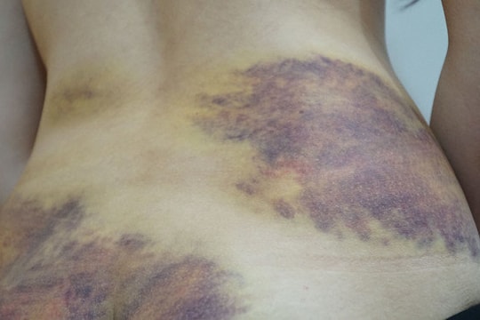 Ghen tuông, người đàn ông ở An Giang đánh đập vợ dã man