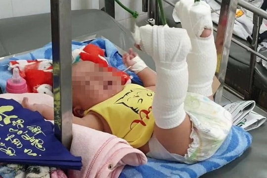 Bắt giữ người cha bạo hành con trai 4 tháng tuổi xuất huyết não ở Sài Gòn