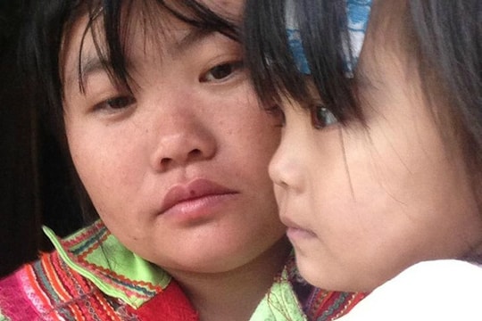 Mùa xuân khó khăn của bé gái 3 tuổi ở vùng cao mang căn bệnh lạ