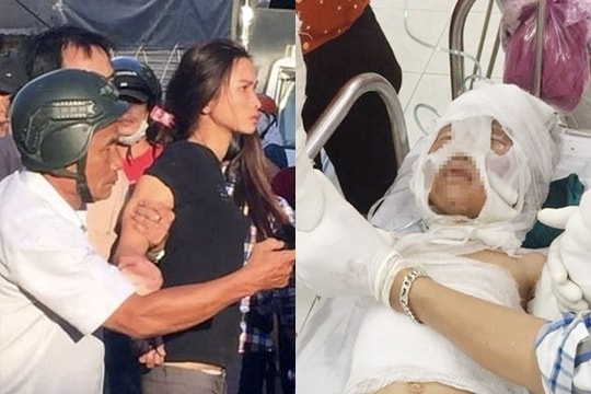 Dì ruột tẩm xăng đốt cháu 6 tuổi bỏng nặng vì khoản nợ 3,9 triệu của bố