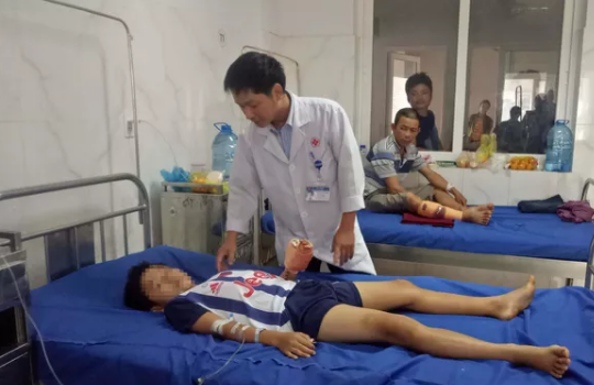 Điện thoại phát nổ khi đang sạc, bé trai 12 tuổi dập nát bàn tay