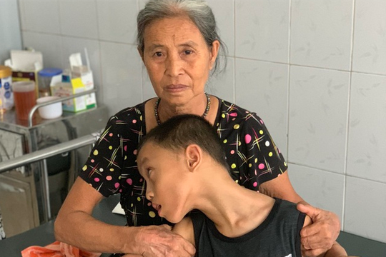 Cụ bà cơ cực xin ăn từng bữa cầm cự nuôi cháu bại não trong viện