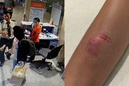 Bị phạt quá cân hành lý, nữ hành khách lao vào cắn nhân viên hàng không