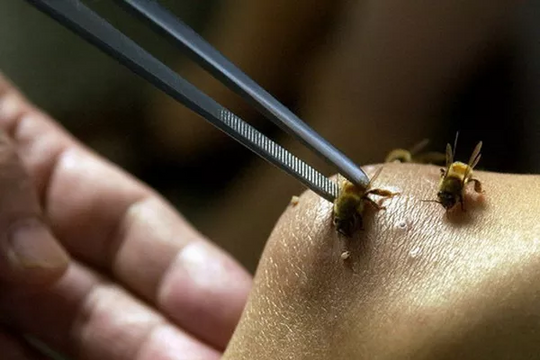 Một người bị ong rừng đốt tử vong tại chỗ khi đi khai thác keo